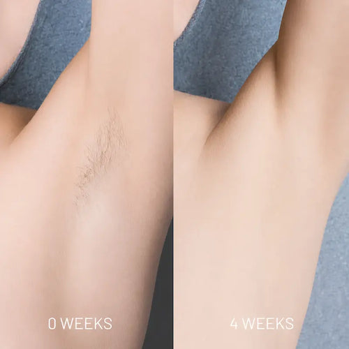 ONORA™ Hair Growth Reduction Oil ⭐